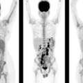 Accurate PET Scan In Mumbai For Cancer Detection &ndash; Picture This