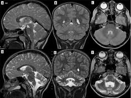London, Health, Get Clear Brain Scan Results With Advanced MRI Services | Marris Medical London