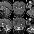 Get Clear Brain Scan Results With Advanced MRI Services | Marris Medical London
