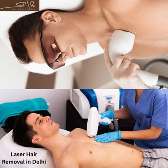 New Delhi, Health, Laser Hair Removal Cost In Delhi: Transparent Pricing With Expert Care