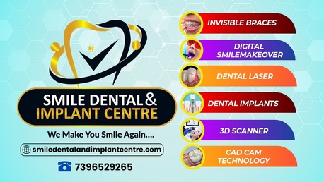 Hyderabad, Dental, Smile Dental & Implant Centre &ndash; Advanced Dental Care In Hyderabad