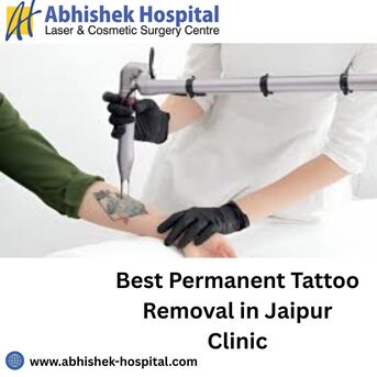 Jaipur, Health, Best Permanent Tattoo Removal In Jaipur Clinic