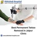 Best Permanent Tattoo Removal In Jaipur Clinic