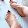 Unlock The Secrets To Bunion Relief: Bunion Treatment