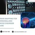 Brain Mapping For Personalized Mood Disorder Care