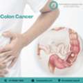 Experienced Colon Cancer Surgeon In Ahmedabad For Personalized Care