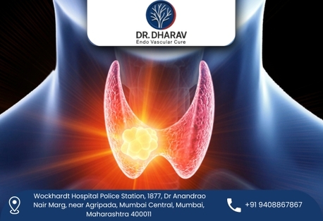 Mumbai, Health, Safe And Modern Procedures For Thyroid Swelling Problems