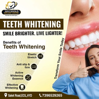 Hyderabad, Dental, Get The Smile Of Your Dreams At Smile Dental & Implant Centre