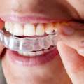 Premier Invisalign Provider In Trivandrum: Transform Your Smile With Expert Clear Aligners