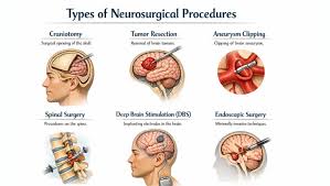 Mumbai, Health, Advanced Techniques Used In Modern Brain & Spine Treatment
