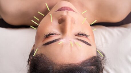 Jumeirah, Medical, Acupuncture Therapy
