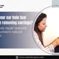 Did Your Ear Hole Tear While Removing Earrings?