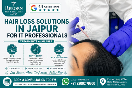 Jaipur, Health & Beauty Items, INR 2500,  Effective Hair Loss Treatment In Jaipur For IT Professionals