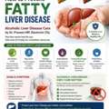 How To Prevent Fatty Liver Disease &ndash; Alcoholic Liver Disease Care By Dr. Praveen MP, Elect