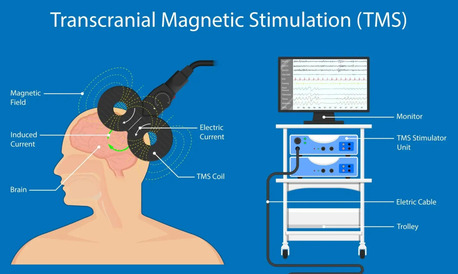 Tampa Bay, Health, Improve Focus & Mental Wellness With Brain Mapping Therapy