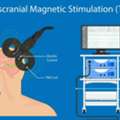 Improve Focus & Mental Wellness With Brain Mapping Therapy