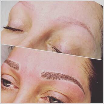 London, Medical, Eyebrow Tattoo