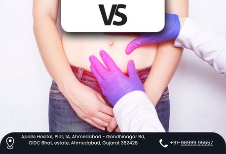 Ahmedabad, Health, Dr. Vishal Soni &ndash; Leading Choice For Complex Hernia Treatment
