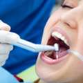 Composite Bonding | Smile Enhancement In Dublin