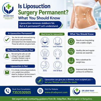 Bangalore, Health, Is Liposuction Surgery Permanent? What You Should Know