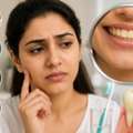 Dental Mouth Night Guards &ndash; Why They Are Important