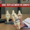 Trusted Knee Replacement In Sonipat For Better Joint Health