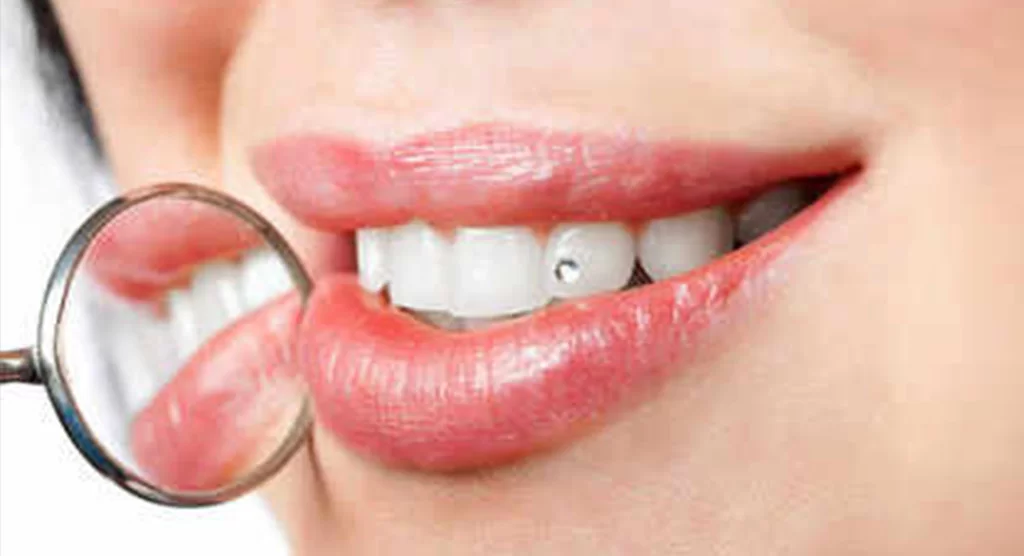 Noida, Health, Cosmetic Smile Designing In East Delhi