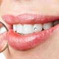 Cosmetic Smile Designing In East Delhi