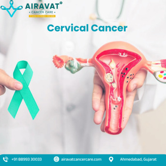 Ahmedabad, Health, Advanced Cervical Cancer Surgery In Ahmedabad | Airavat Cancer Care