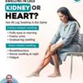 Leg Swelling: Kidney Or Heart? | Dr. Pabitra Misra Bhubaneswar