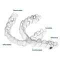 Invisalign Surrey - Clear Aligners For Teens & Comfortable Care