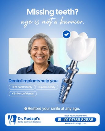 Mumbai, Dental, Dental Implants In Ravet​ - Dr Rudagi