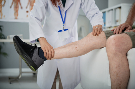 Madurai, Health, Varicose Veins Ayurvedic Treatment In Madurai