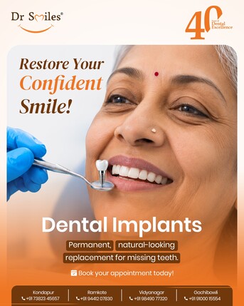 Hyderabad, Dental, Best Dental Implants In Kondapur- Dr Smiles