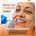Best Dental Implants In Kondapur- Dr Smiles
