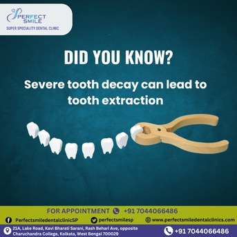 Kolkata, Dental, Perfect Smile Super Specialty Dental Clinic