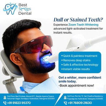 Hyderabad, Dental, Zoom Teeth Whitening In Kondapur - Best Smiles Dental