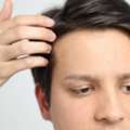 Hair Loss Treatment Fort Collins Restore Fuller Hair