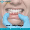 Trusted Oral Cavity Cancer Treatment In Ahmedabad - Airavat Cancer Care