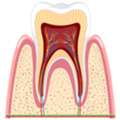 Best Root Canal Treatment In Noida For Lasting Relief