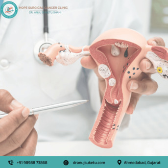 Ahmedabad, Health, Trusted Uterus Cancer Specialist In Ahmedabad - Dr. Anuj Suketu Shah