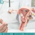 Trusted Uterus Cancer Specialist In Ahmedabad - Dr. Anuj Suketu Shah