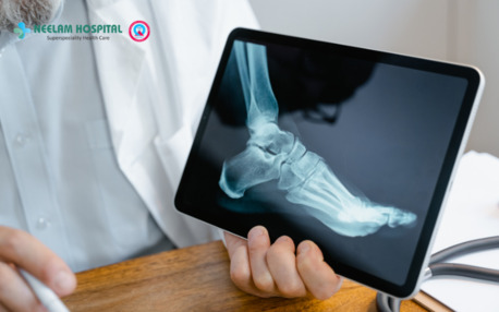 Kabul, Health, Fracture Healing Natural Remedies