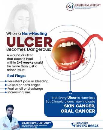 Bhubaneswar, Health, Non-Healing Ulcer: Skin & Oral Cancer Signs | Dr Srigopal Mohanty Bhubaneswar