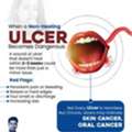 Non-Healing Ulcer: Skin & Oral Cancer Signs | Dr Srigopal Mohanty Bhubaneswar