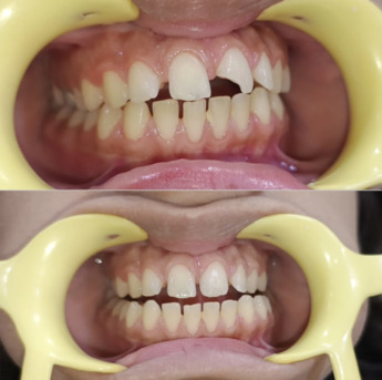 Dwarka, Dental, Modern Dental Clinic & Dentist In Dwarka Sector 19
