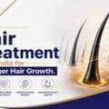 Best Hair Treatment In India For Stronger Hair Growth