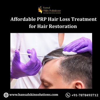 Jaipur, Health, Affordable PRP Hair Loss Treatment For Hair Restoration