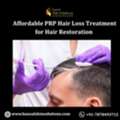 Affordable PRP Hair Loss Treatment For Hair Restoration
