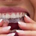 Checkout The Ultimate Guide To Nightguards From Nearby Dental Clinic In Ormeau City